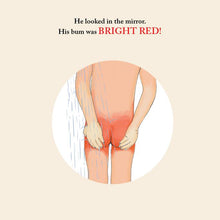 Load image into Gallery viewer, The Adventures of Willy and his Sunburnt Bum!
